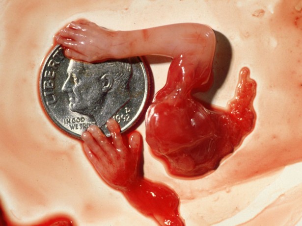 73 miliony zabitych dzieci rocznie. Ofiary biznesu aborcyjnego