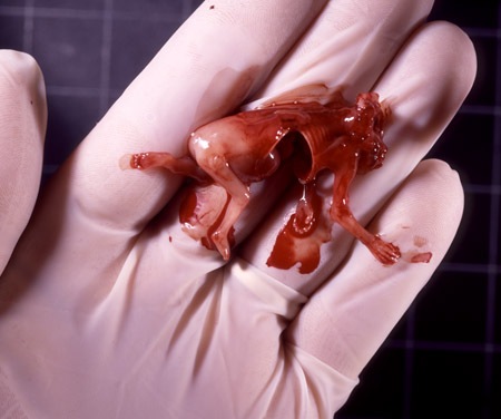 Częstochowa: aborterzy pomogli zabić bliźnięta. Bez przeszkód działają dalej