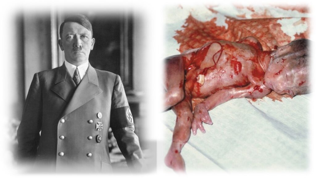 Obraz przedstawia Adolfa Hitlera oraz zabite nienarodzone dziecko. Adolf Hitler i legalizacja aborcji dla Polek.